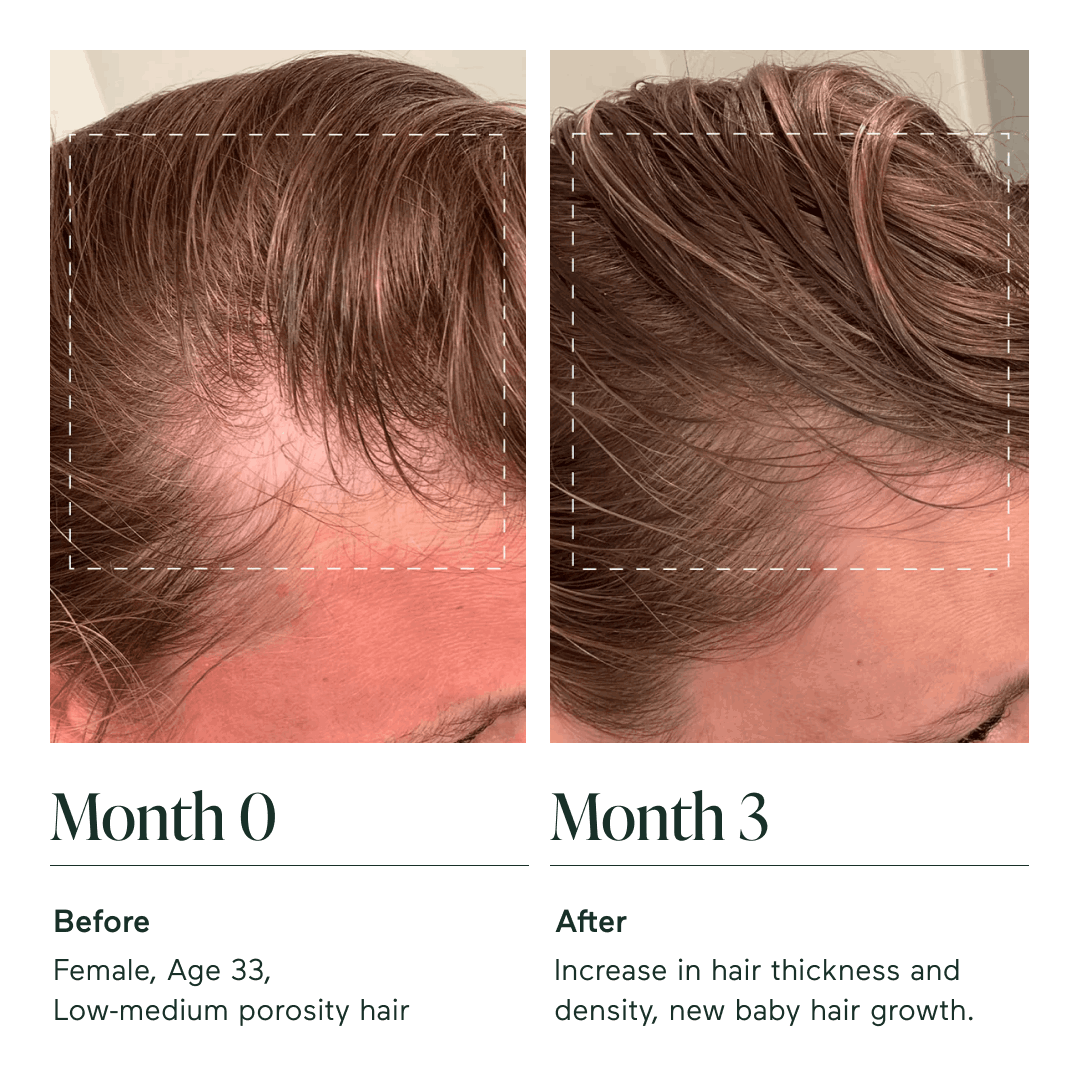 The Hair Multiplier